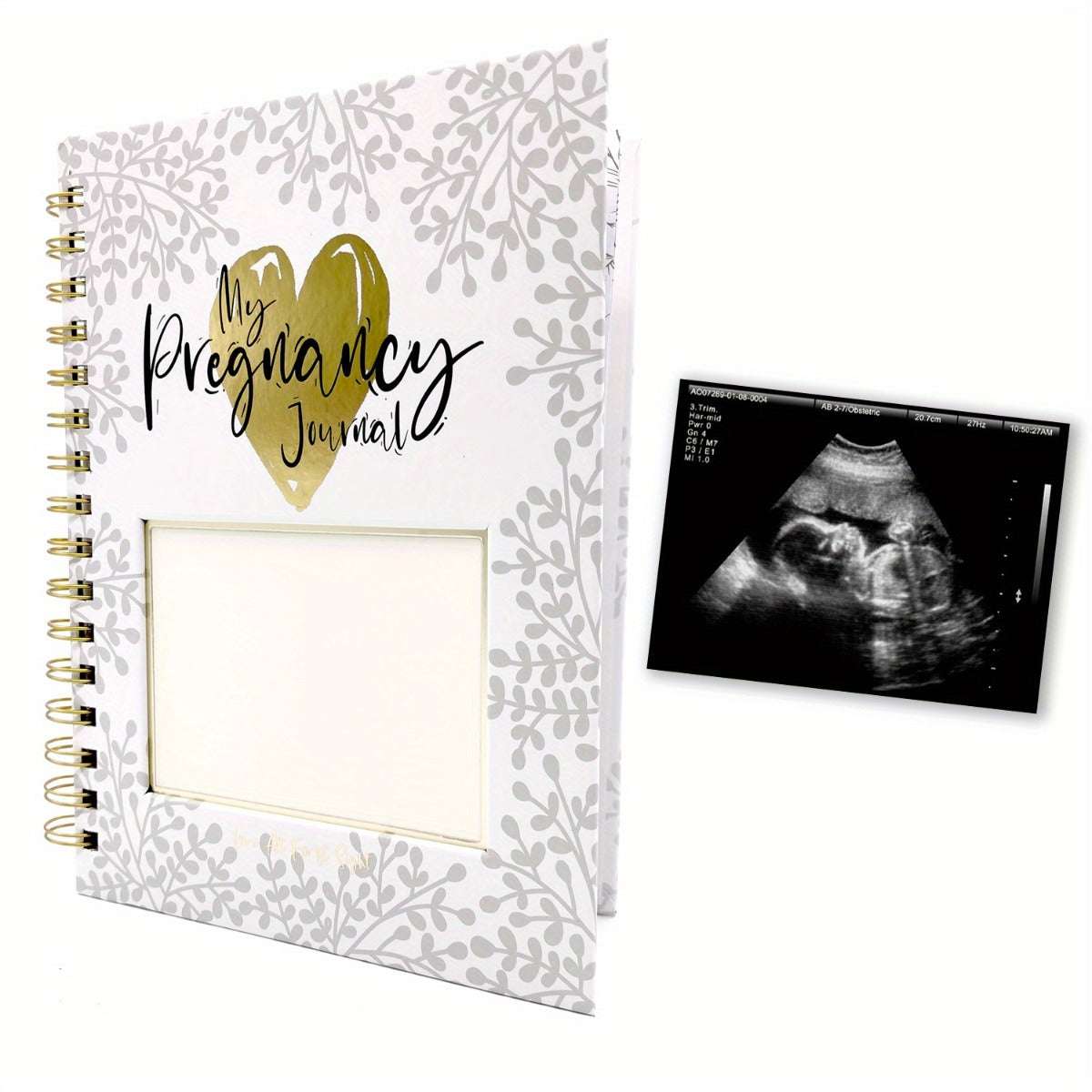 Pregnancy Journal Memory Book